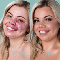 Professional camouflage makeup lesson for scars and skin conditions at Kryolan 