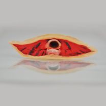Kryolan Cut Larynx wound